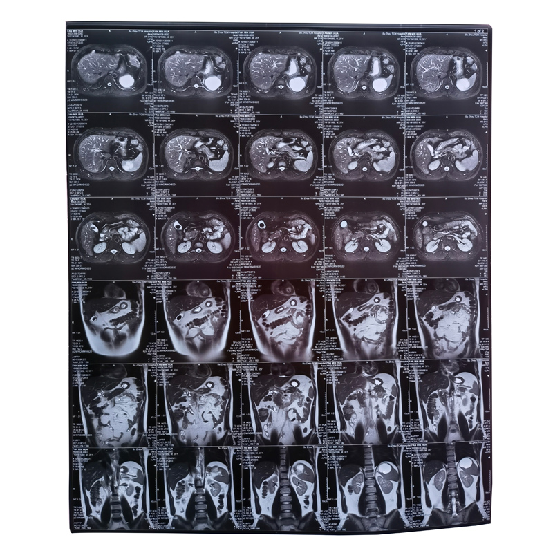 Dry film